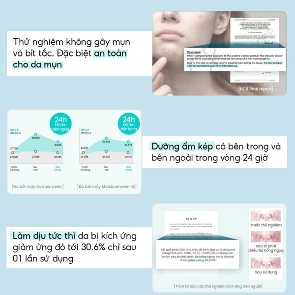Kem dưỡng ẩm Tinh Linh Nước làm dịu Beyond Angel Aqua Moisture Cream - Ảnh 7