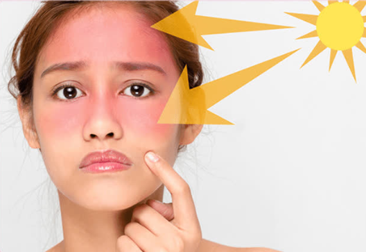 kem chống nắng phổ rông chống tia UV